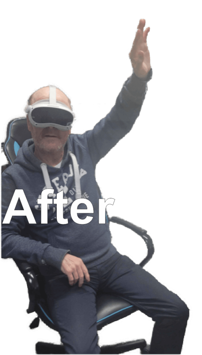 After rehabilitation — arm raised