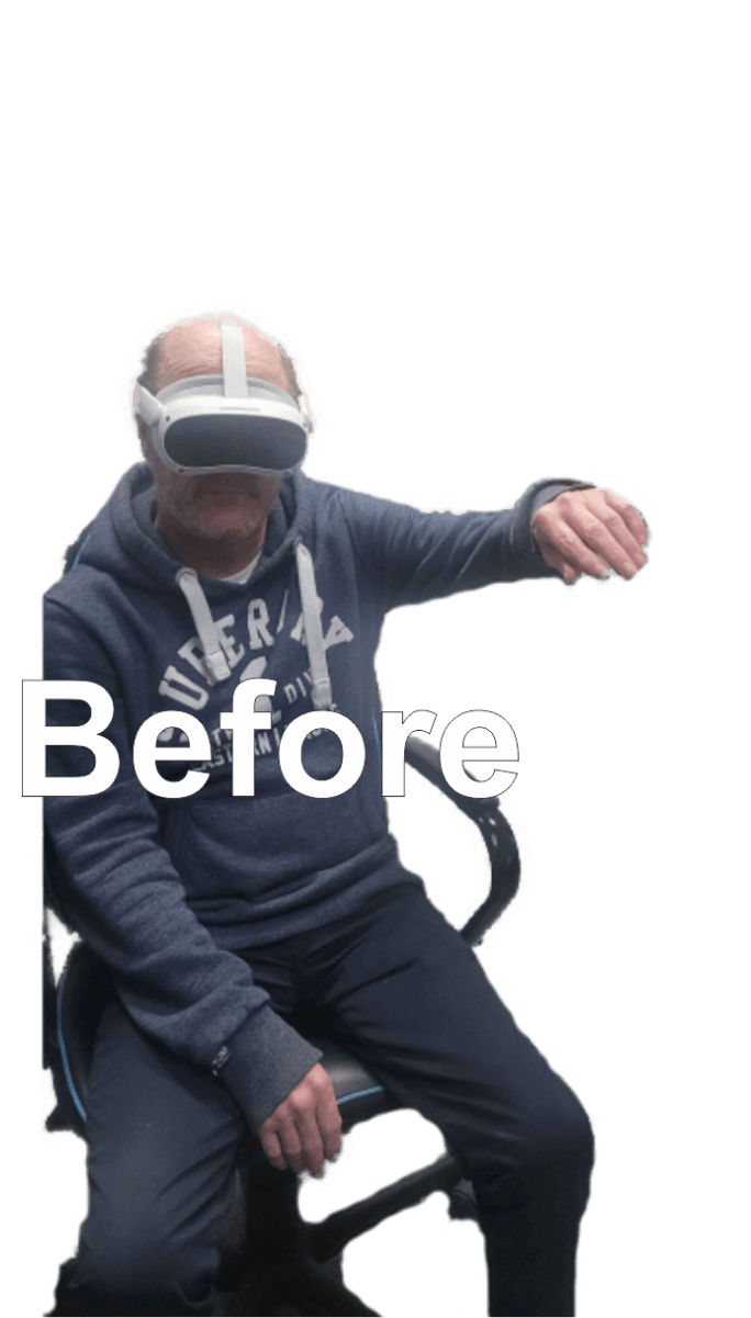 Before rehabilitation — arm at rest